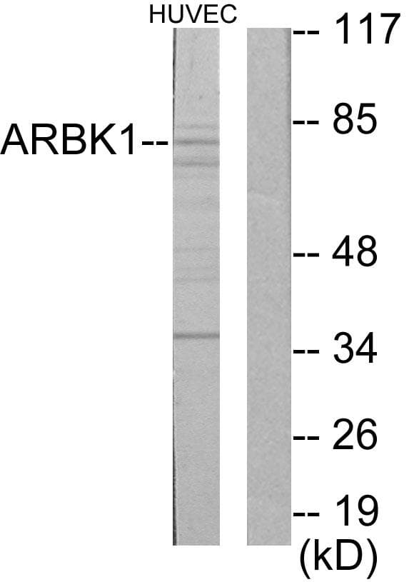 ADRBK1 / GRK2 Antibody