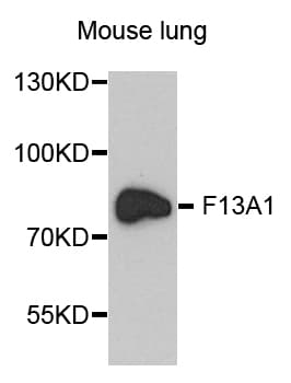 F13A1 / Factor XIIIa Antibody