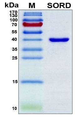 Human SORD / Sorbitol Dehydrogenase Protein (Recombinant 6His, N-terminus)