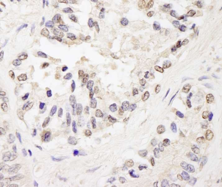 IHC-plus™ ZFPM1 / FOG1 Antibody (aa175-225)