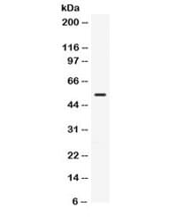 TGFBR1 / ALK5 Antibody