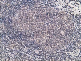 ADH2 / ADH1B Antibody (clone OTI4F12)