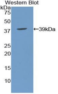 Apolipoprotein C-I Antibody (aa32-88)