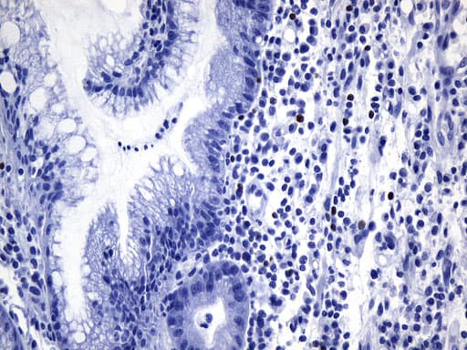 FOXP3 Antibody (clone UMAB248)