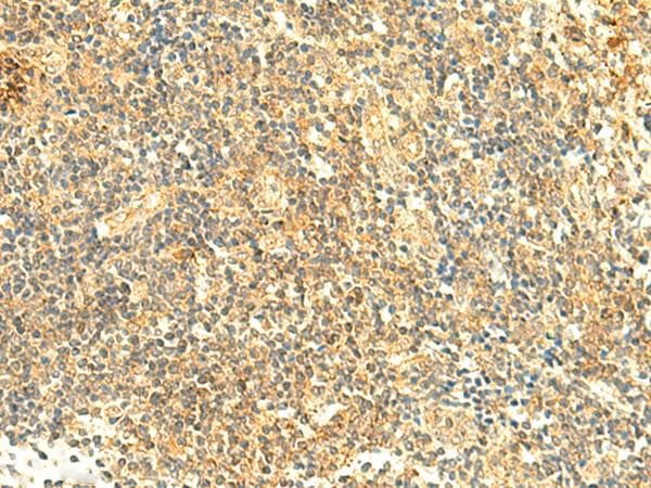 ARL4D Antibody