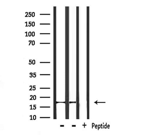 Polyclonal Rabbit anti-Human NDUFA13 / GRIM19 Antibody (IHC, WB)