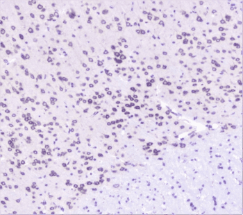 UBE2I / UBC9 Antibody
