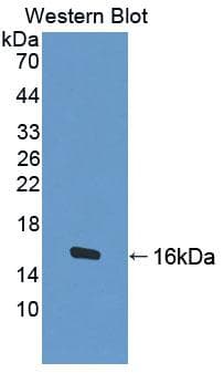 BCHE / Cholinesterase Antibody (aa29-150)