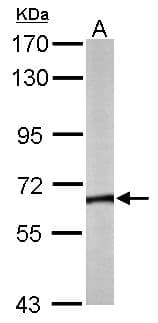 Polyclonal Rabbit anti-Human CCT8 Antibody (aa111-367, IHC, WB)