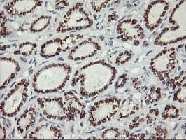 KCNJ3 / GIRK1 Antibody (clone OTI1G3)