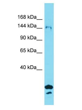 Polyclonal Rabbit anti-Human SYDE2 Antibody (aa233-282, WB)