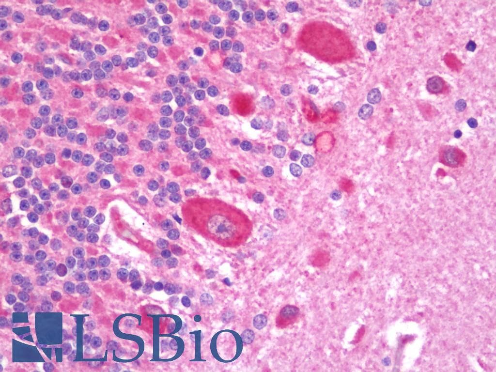 IHC-plus™ TNFRSF11A / RANK Antibody