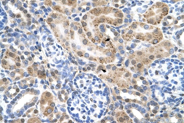 Polyclonal Rabbit anti-Human SLC22A3 / OCT3 Antibody (FITC, aa46-95, IHC, WB)