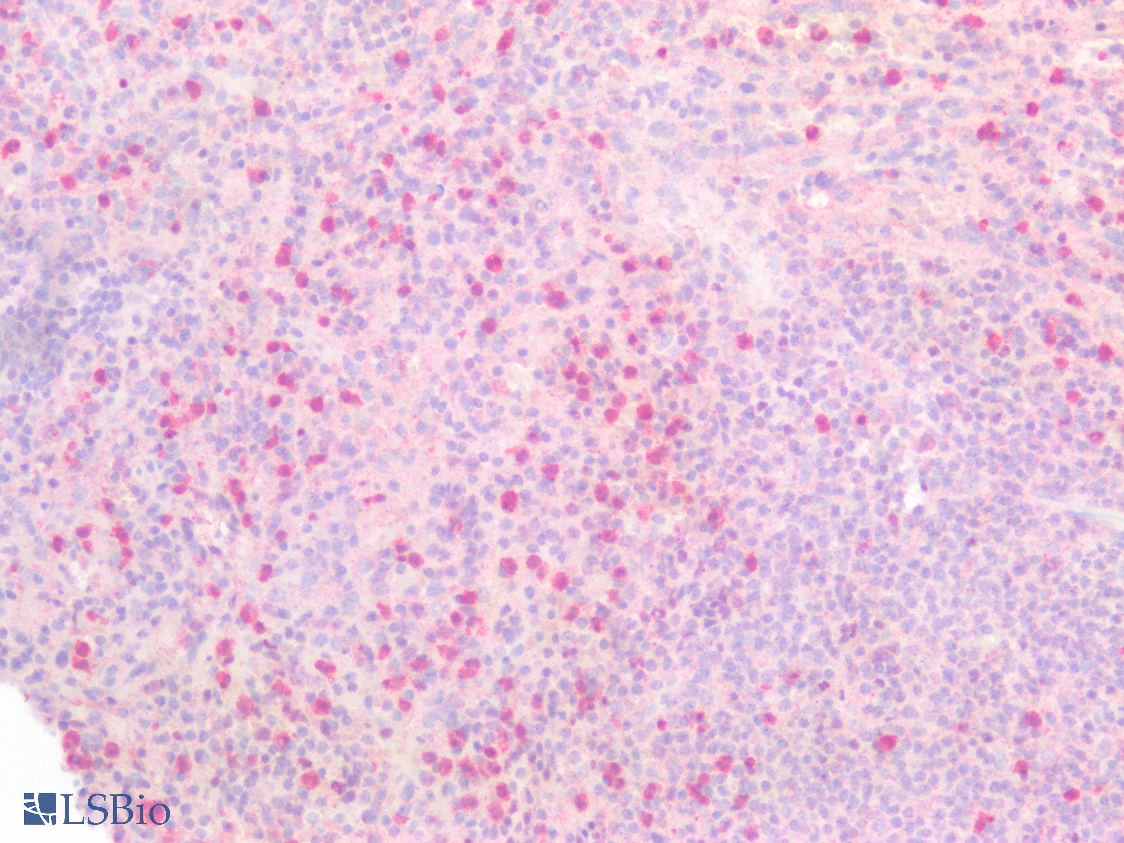 TNFRSF21 / DR6 Antibody (aa406-605)