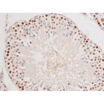 Polyclonal Rabbit anti-Human MAPT / Tau Antibody (phospho-Ser235, IHC, WB)