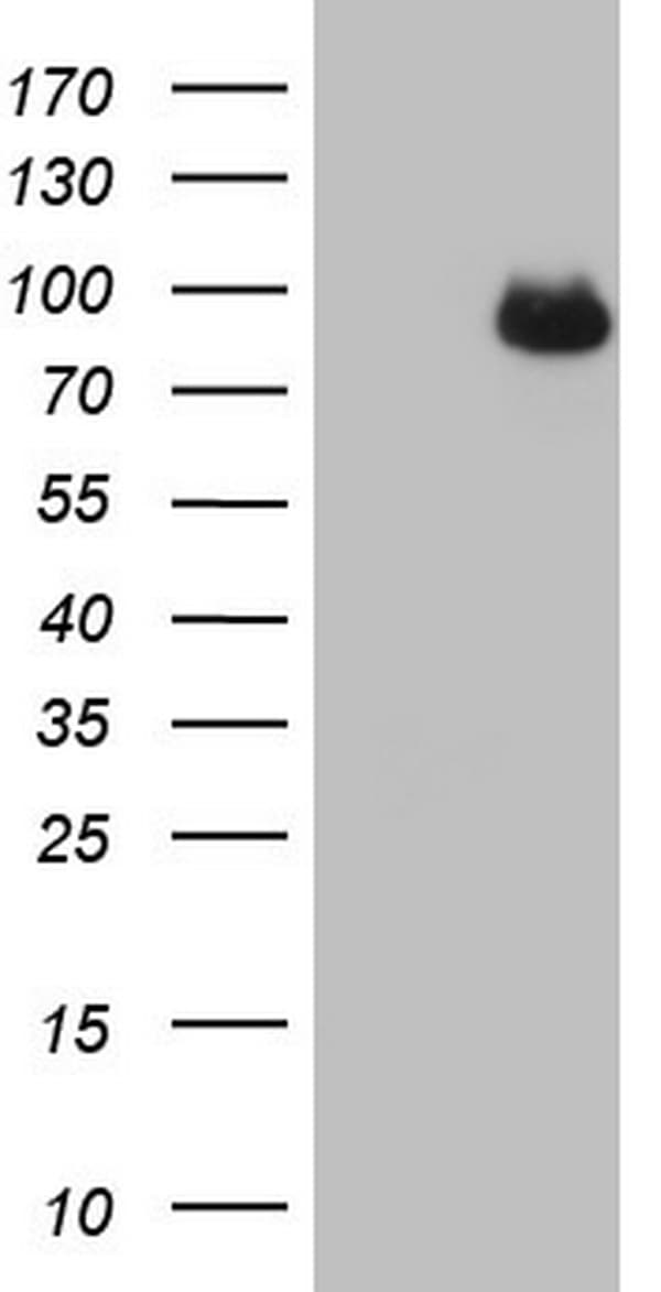 Monoclonal Mouse anti-Human CFI / Complement Factor I Antibody (clone OTI15E11, Carrier-free, aa340-583, IHC, WB)