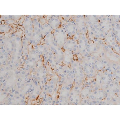 SYN / FYN Antibody (phospho-Tyr530)
