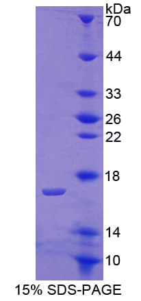 Human COMP / THBS5 Protein (Recombinant His-T7)