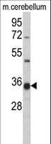 GGPS1 Antibody (aa270-300)