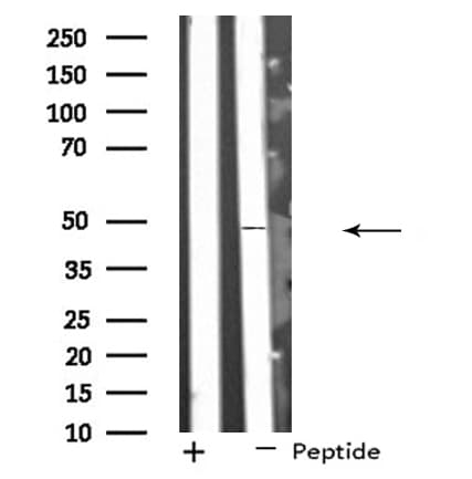 SYT13 Antibody