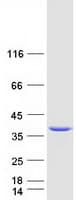 Human NPL / C112 Protein (Recombinant Myc-DDK (Flag))