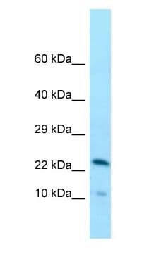 CCDC43 Antibody (N-Terminus)