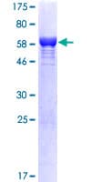 Human CIAPIN1 / Anamorsin Protein (Recombinant GST)