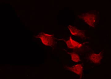 IKBKG / NEMO / IKK Gamma Antibody