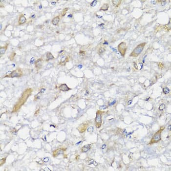 SPICE1 / CCDC52 Antibody