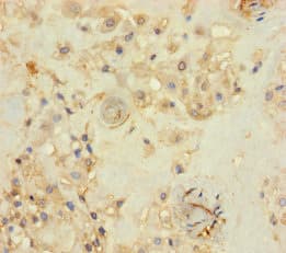 Polyclonal Rabbit anti-Human PRKRIR Antibody (WB)