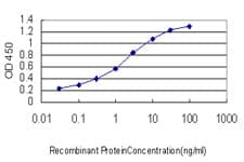Monoclonal Mouse anti-Human Growth Hormone Receptor / GHR Antibody (clone 3A12, WB)