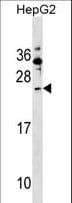 SHISA5 / SCOTIN Antibody (aa75-102)