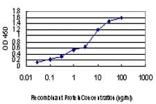 LRP5 Antibody (aa41-130, clone 1E9)