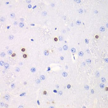 Polyclonal Rabbit anti-Human TKT / Transketolase Antibody (IHC, WB)