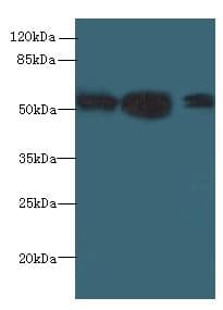Polyclonal Rabbit anti-Human IMPDH2 Antibody (IHC, WB)