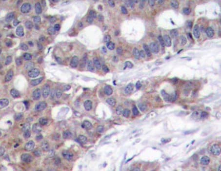 Polyclonal Rabbit anti-Human STMN1 / Stathmin / LAG Antibody (phospho-Ser16, IHC, WB)