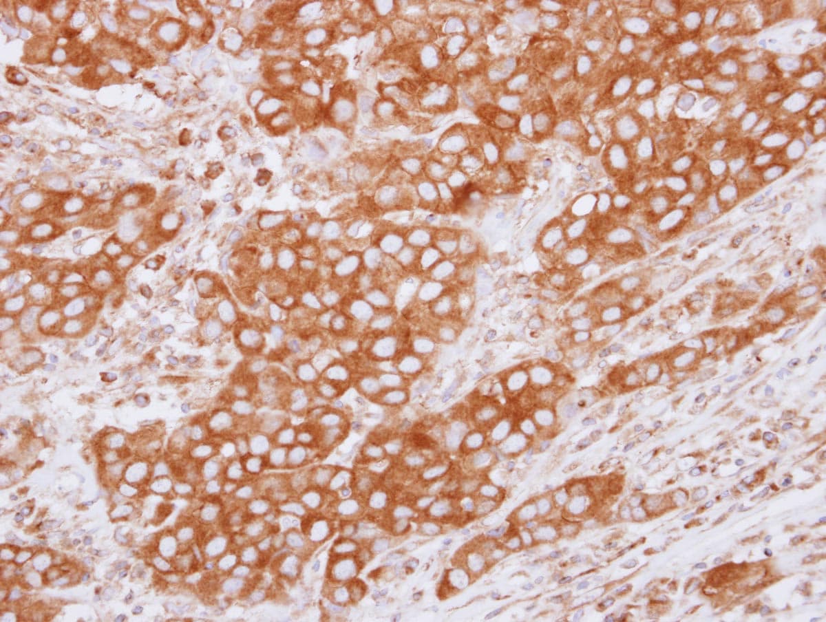 TUBB4B / Tubulin Beta 4B Antibody (Internal)