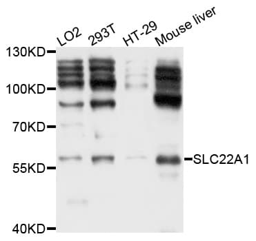 IHC-plus™ Polyclonal Rabbit anti-Human SLC22A1 Antibody (IHC, WB)