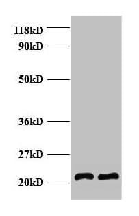 Polyclonal Rabbit anti-Human AP50 / AP2M1 Antibody (IHC, WB)
