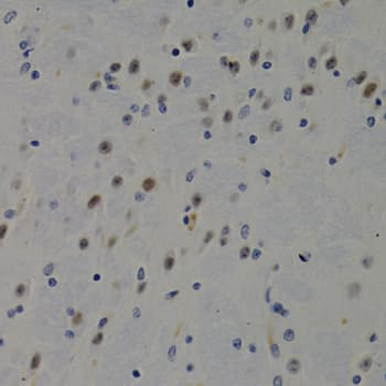 DNMT3B Antibody