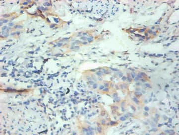 FABP3 / H-FABP Antibody