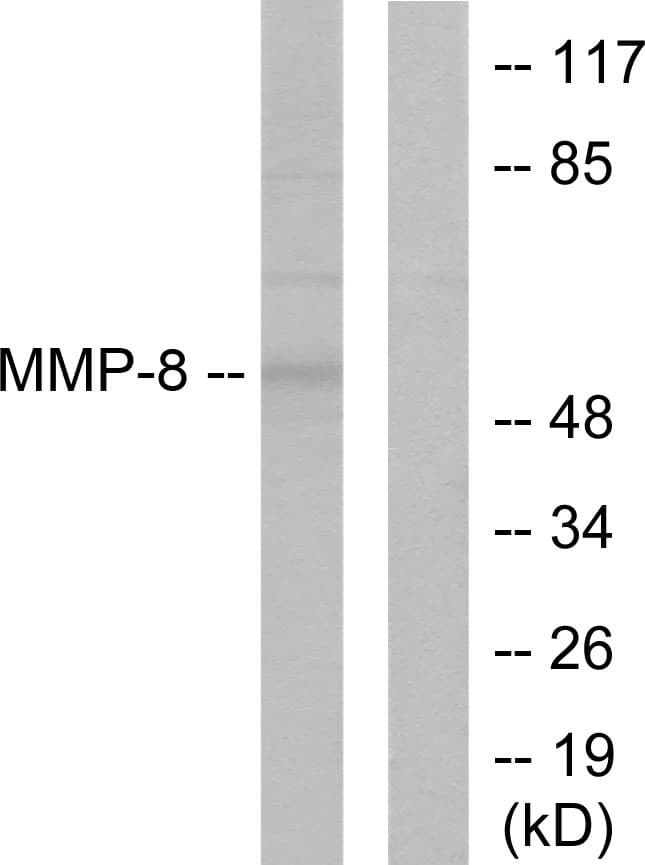 Polyclonal Rabbit anti-Human MMP8 Antibody (aa418-467, IHC, WB)