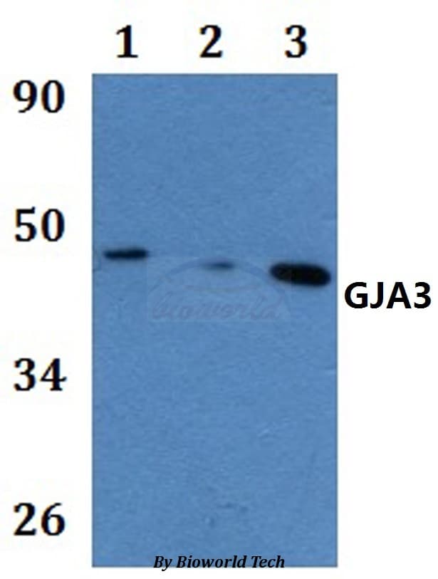Polyclonal Rabbit anti-Human GJA3 / CX46 / Connexin 46 Antibody (WB)
