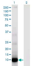 DEFA6 / Defensin 6 Antibody (clone 2D2)