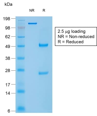 CALD1 / Caldesmon Antibody (clone rCALD1/820, Azide-free, Carrier-free)