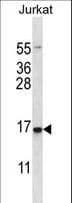 DDIT3 / CHOP Antibody (aa82-110)