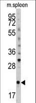 Polyclonal Rabbit anti-Mouse BID Antibody (Ser61, IHC, WB)