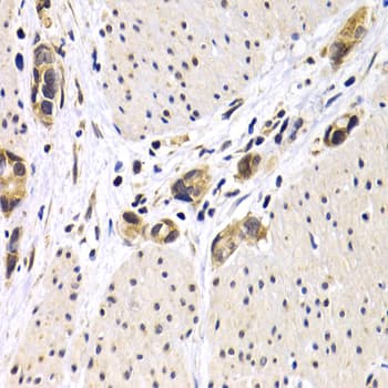 ATF2 Antibody