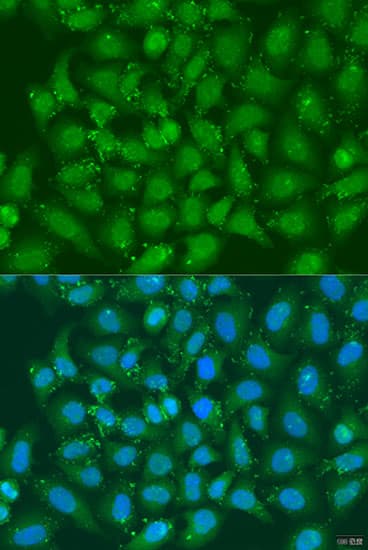 XBP1 Antibody