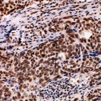 Polyclonal Rabbit anti-Human PDIK1L Antibody (IHC, WB)